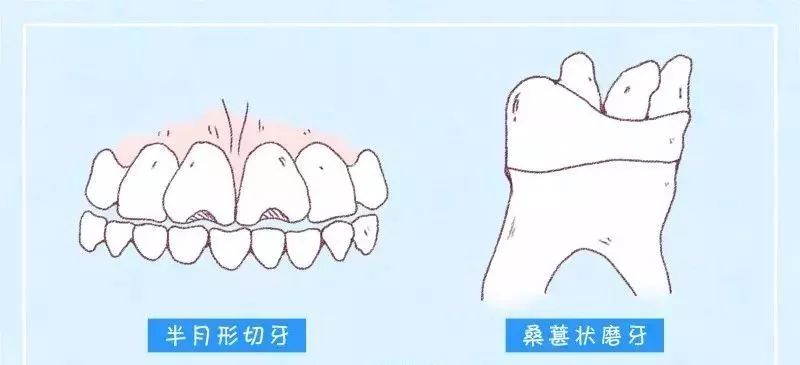 梅毒最新治疗方法，研究与进展概述